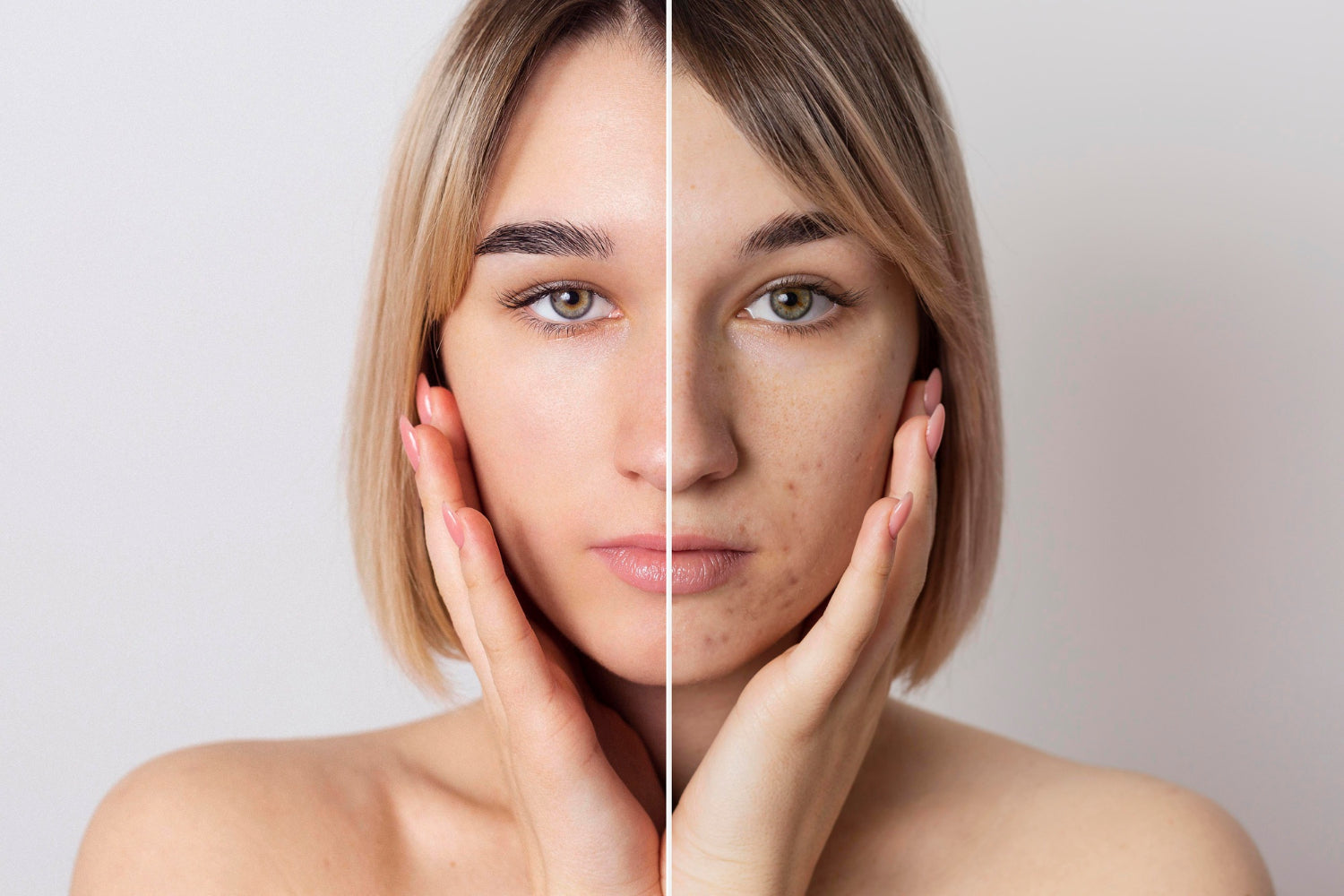 Image by <a href="https://www.freepik.com/free-photo/before-after-portrait-woman-retouched_18962227.htm#query=microneedling&position=9&from_view=search&track=sph">Freepik</a>